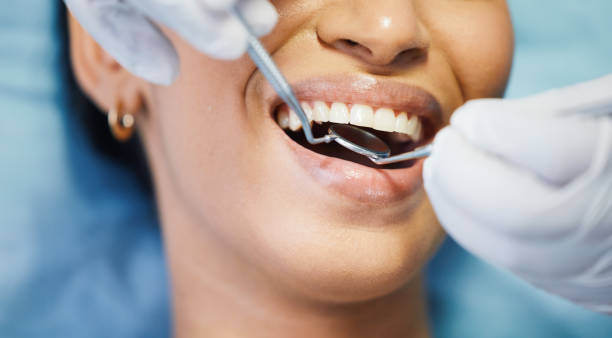 Best Emergency Dentist for Lost Fillings or Crowns in Ephrata, PA